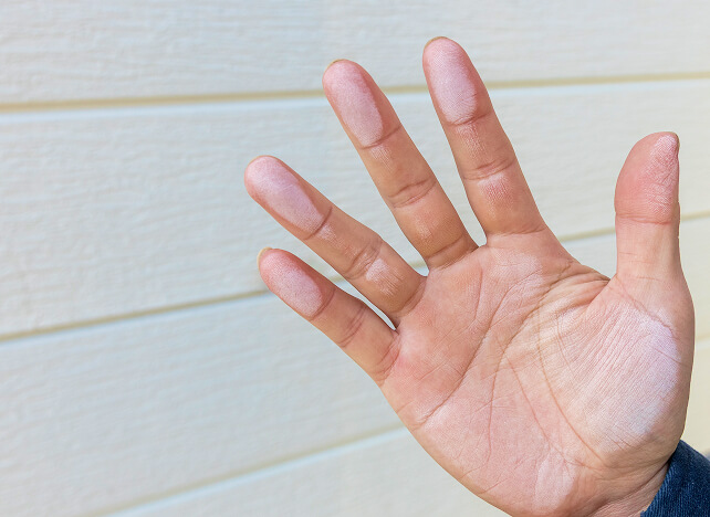 外壁を手で触ると白い粉が付着している様子